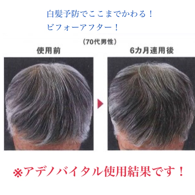 どうして白髪ができるのか その原因はなんなのか 白髪に対してのケア方法 奈良 京都 大阪の美容室 ハピネス